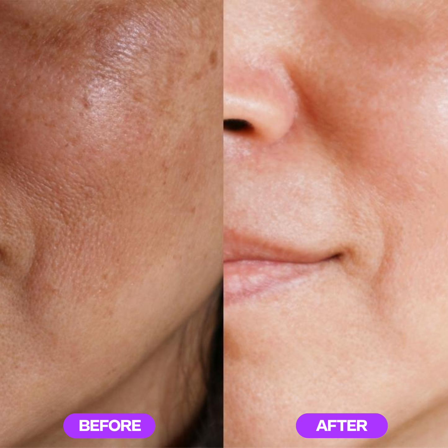 CitraGlow™ - Active Enzyme Exfoliator