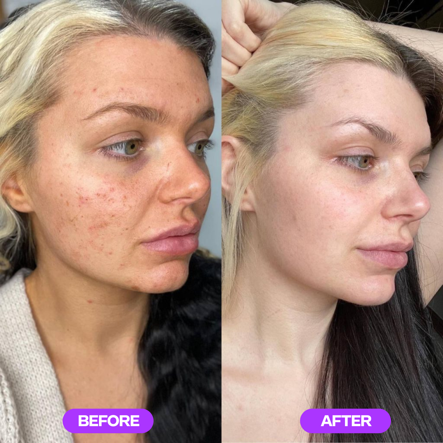 CitraGlow™ - Active Enzyme Exfoliator