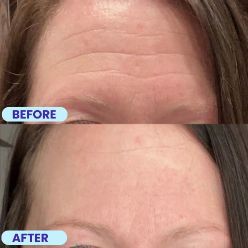 Noîr™ Overnight Wrinkle Smoothing Patches