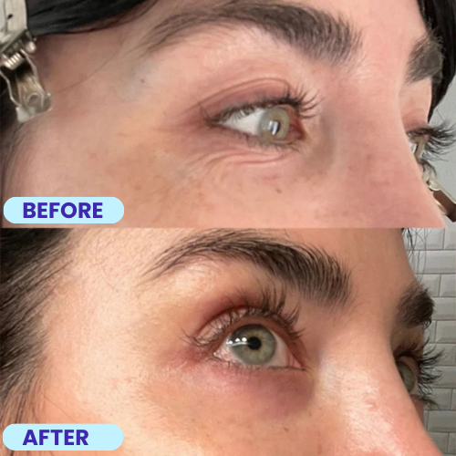 Noîr™ Overnight Wrinkle Smoothing Patches