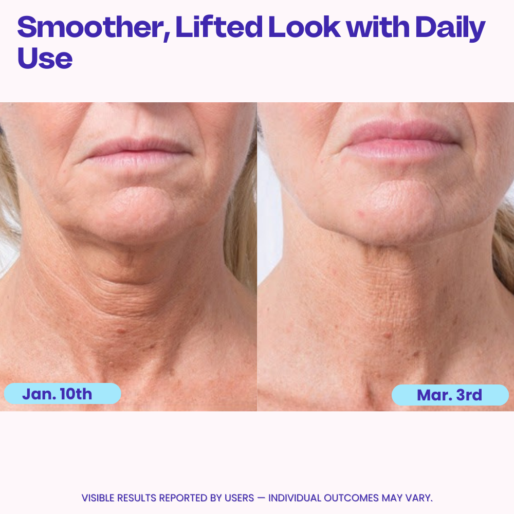 DermaLift™ Tighten & Firming Neck Cream