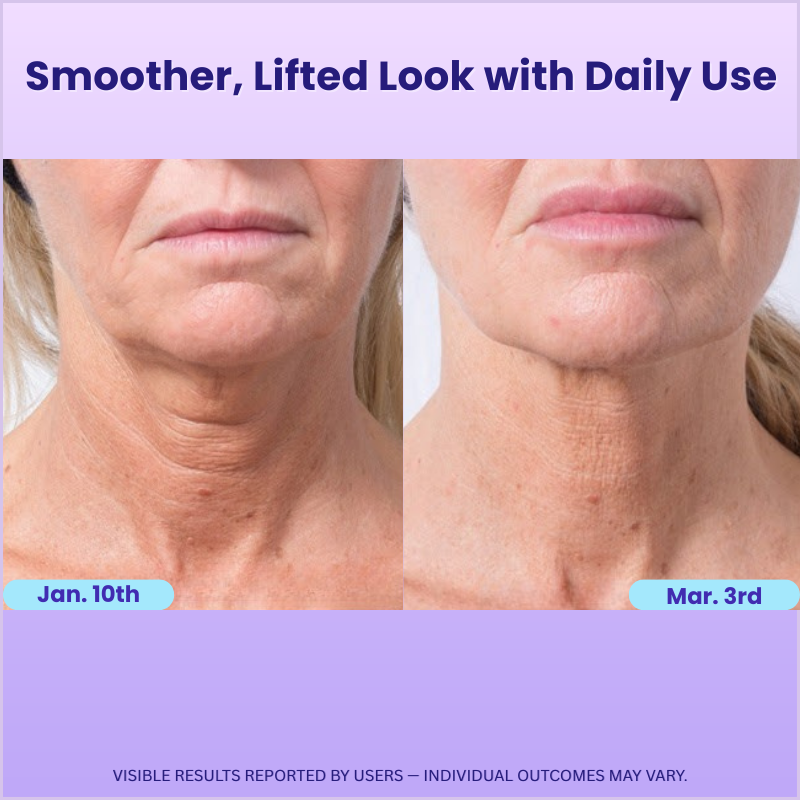 DermaLift™ Tighten & Sculpt Neck Cream